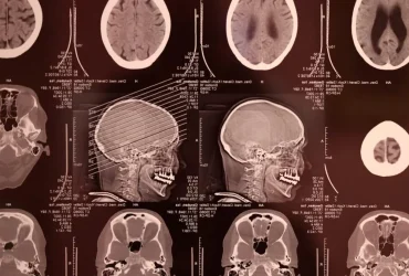 Meta’s Brain2Qwerty v2: IA Traduz Escaneamentos Cerebrais em Texto